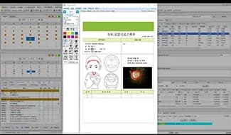 스마트NC 에서 확인하는 스마트차트 기록