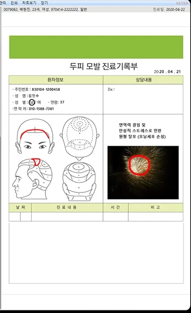 스마트펜차트 두피 모발 진료기록부 화면
