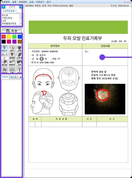 스마트펜차트 두피 모발 진료기록부 화면 — 왼쪽 펜 도구모음 포함